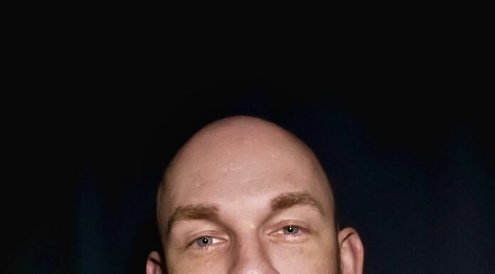 Interview: Matt Hudson of Chippendales is getting comfortable being uncomfortable Matt Hudson