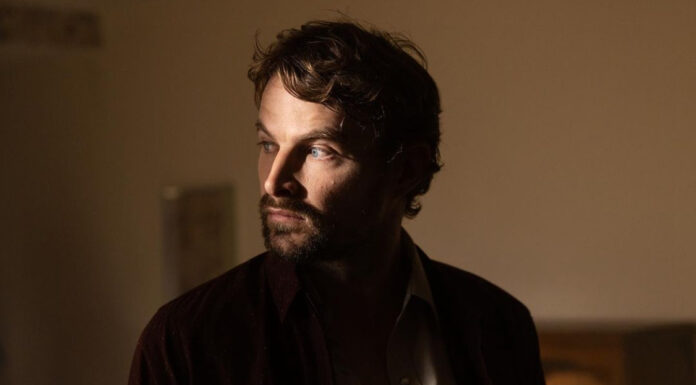 James Preston is Emmy-worthy for his acting in ‘The Plastic Men’ James Preston